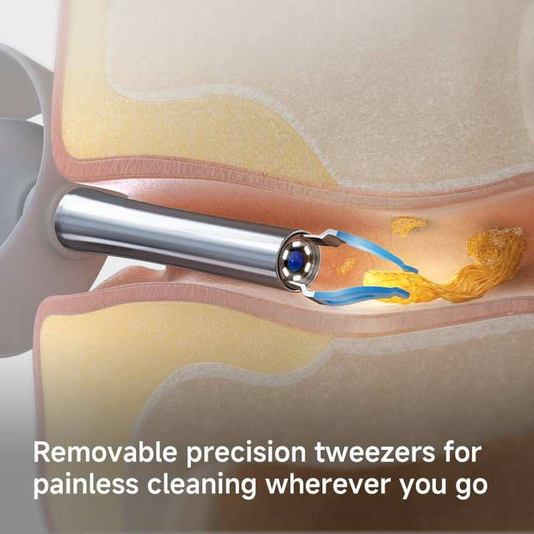 گوشپاککن هوشمند bebird مدل I35R Pro جهت تمیز کردن گوش